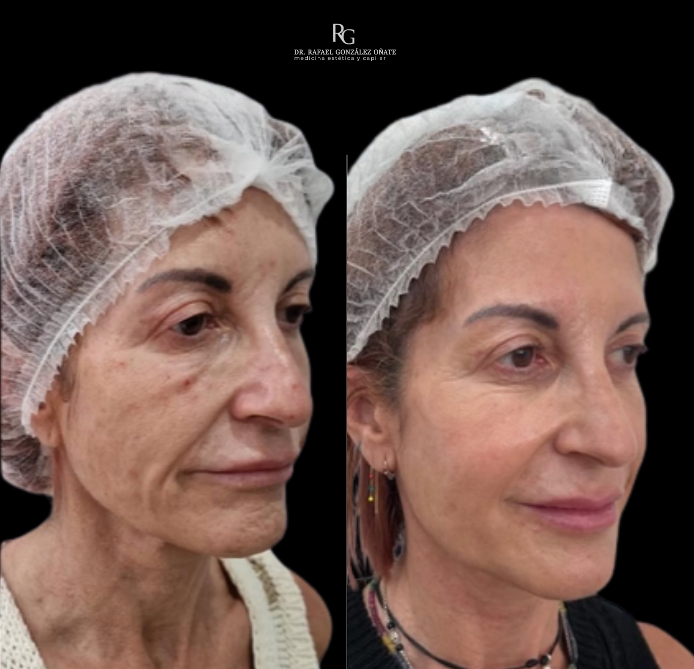 medicina estética y capilar (1400 x 1350 px) (1)